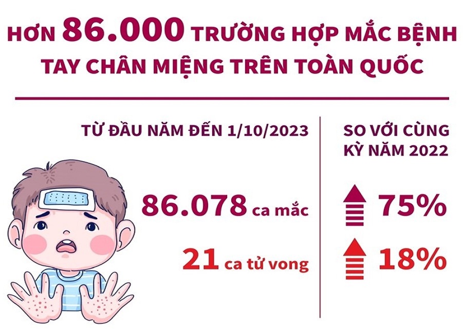 Số ca mắc bệnh tay chân miệng tăng tới 75% so với năm trước