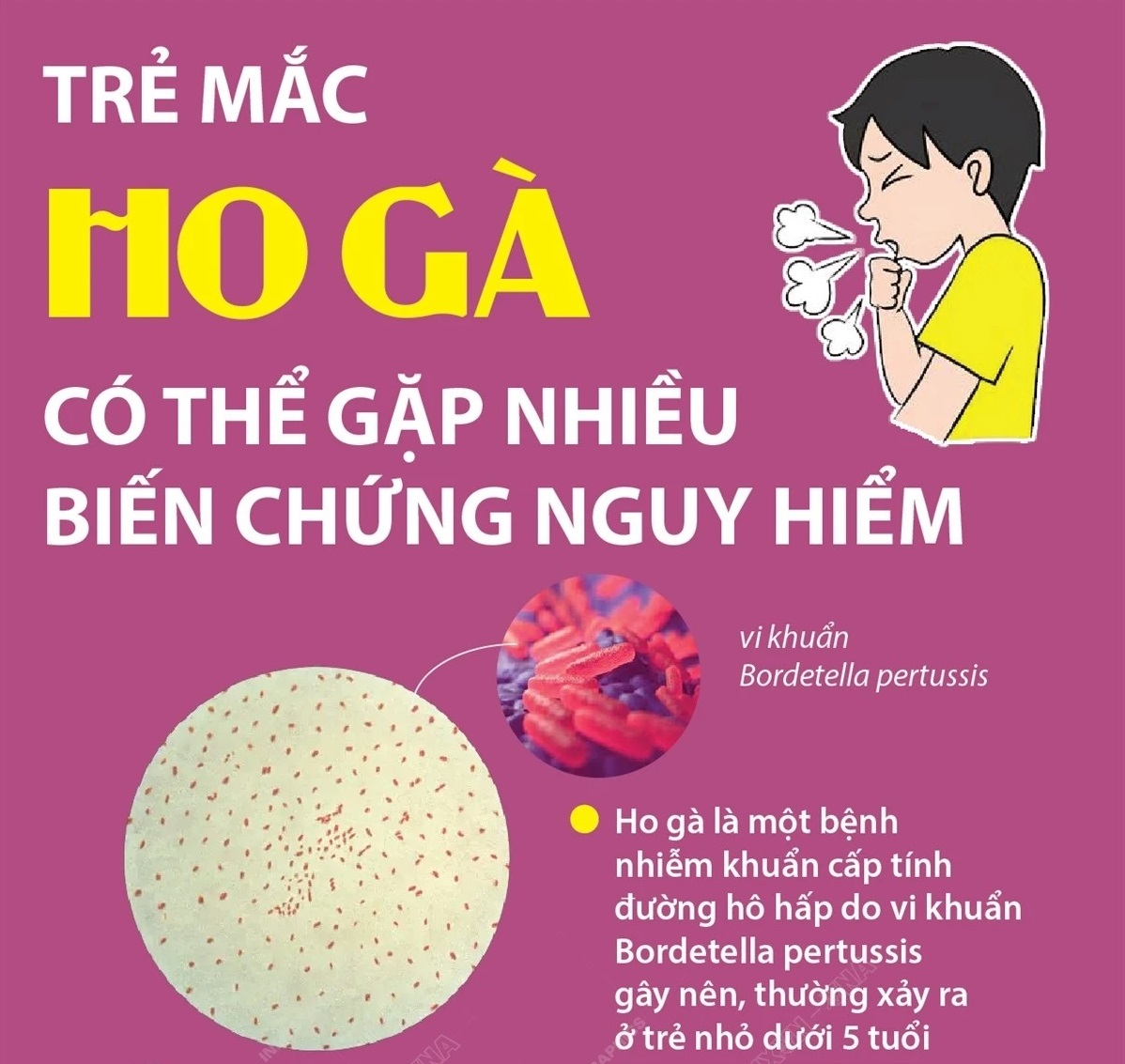 Trẻ mắc ho gà có thể gặp nhiều biến chứng nguy hiểm